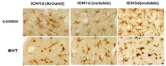 Iba-1 immunohistochemistry