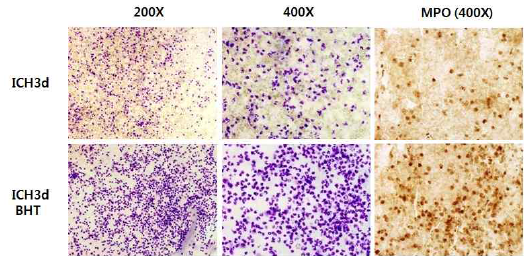 Iba-1 immunohistochemistry