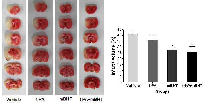mBHT와 t-PA의 병용투여에 의한 뇌경색 억제효과 비교