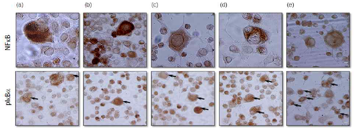 Effects of mBHT on H2O2-induced subcellular localization of NF-κB-IkBα.