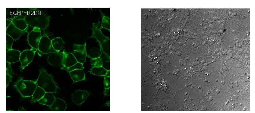 stable cell line and striatal primary culture neuron