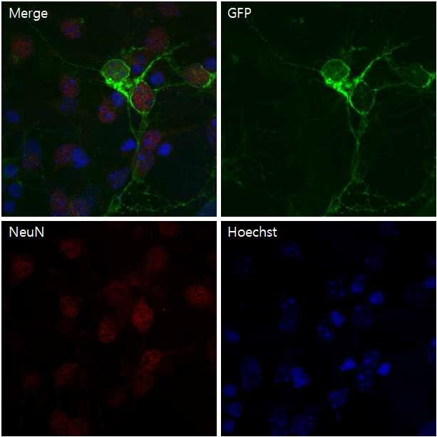 Striatal primary neuron 상의 pll D2DR-EGFP viral expression