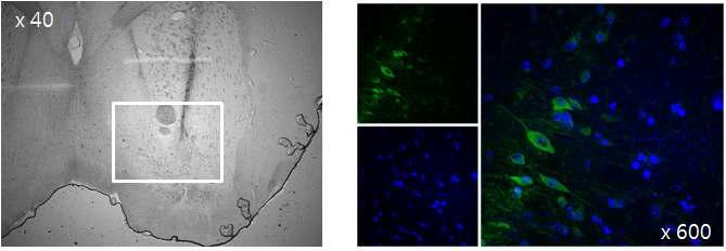 NAc에서의 pll D2DR-EGFP viral expression