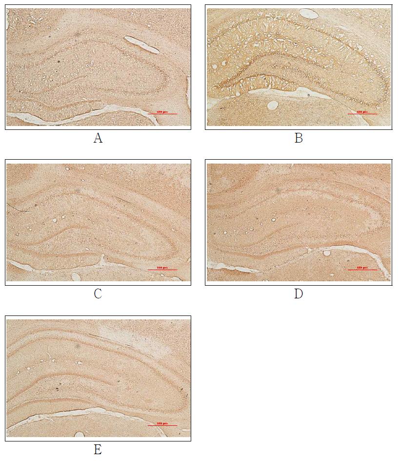 Representive microphotographs of coronal sections in the hippocampal CA1.