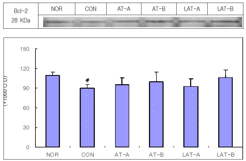 Effect of manual acupuncture,and laser acupuncture at the Heart Jeonggyeok acupoint on the intensity of Bcl-2 in the hippocampus