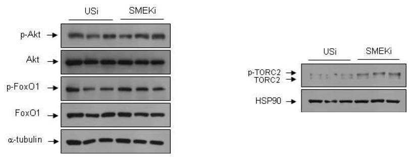 Ad SMEK1+2 RNAi 또는 Ad US 아데노바이러스를 db/db mouse에 주사한 생쥐의 간에서 단백질을 분리하여 westernblot을 수행함.