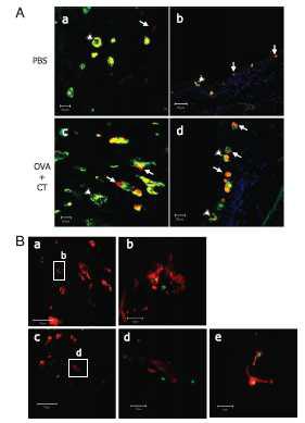 Sampling and internalizing of bacteria by UEA-1+ M celllike cells in conjunctival epithelium of nictitating membrane.