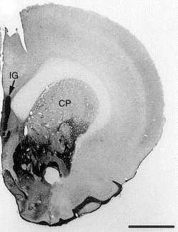 Nucleus accumbens 에서의 CART immunostaining. Scale bar 는 0.5 mm 이다.