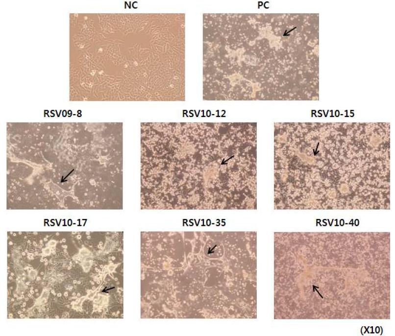 HEp-2 세포주에서 배양된 RSV 야생주가 나타내는 형태학적 특징.