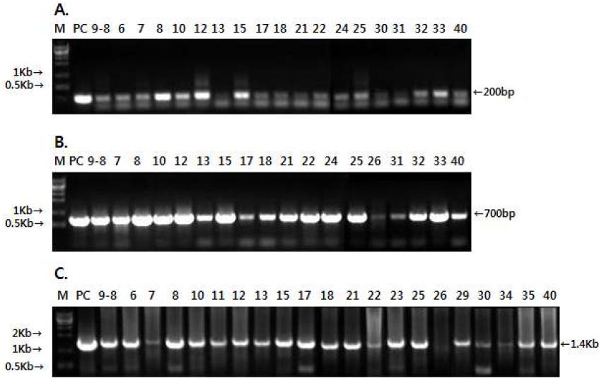 특이적인 primer 조합에 의해 증폭된 PCR 산물의 전기영동