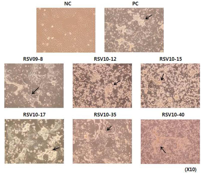 HEp-2 세포주에서 배양된 RSV 야생주가 나타내는 형태학적 특징.
