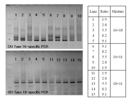 Type specific PCR 결과