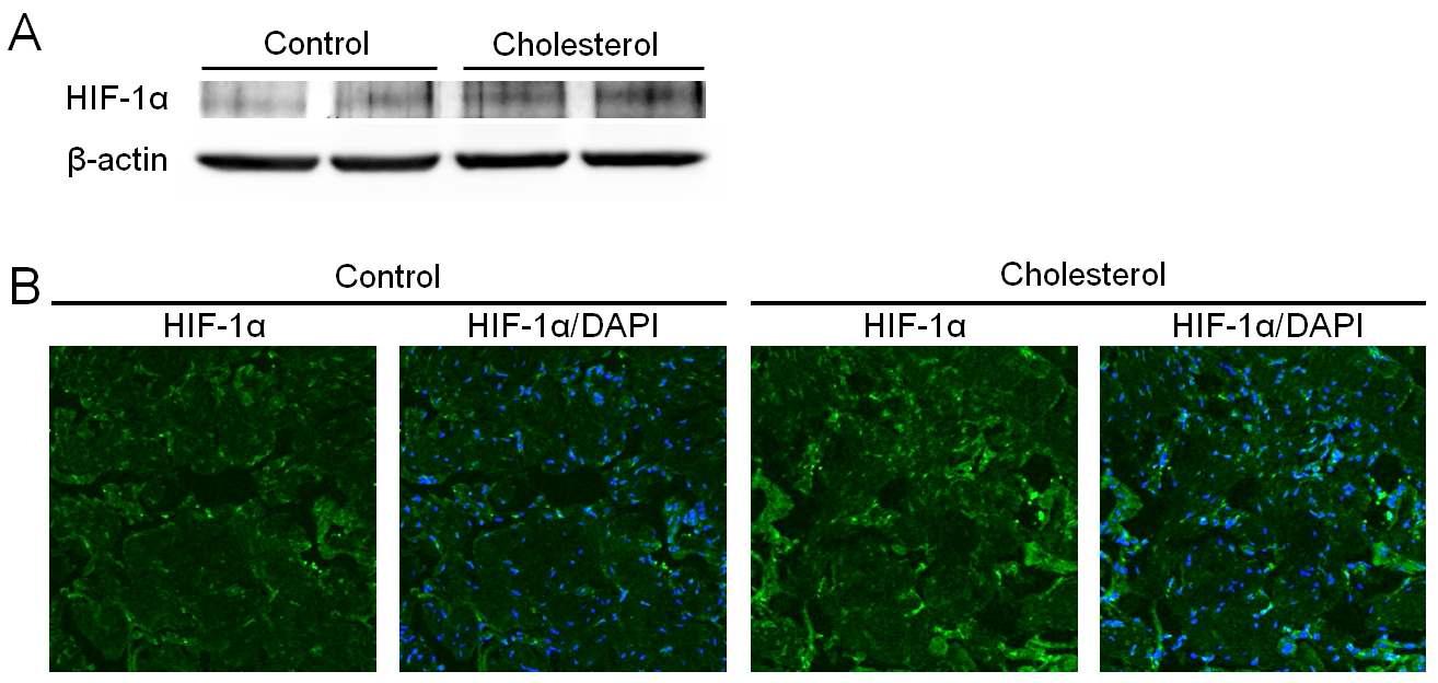 HIF-1 expression in the corpus cavernosum α tissue of control and hypercholesterolemic mice. (A) Western blot analysis showing the protein expression of HIF-1α. (B) Immunohistochemical staining of cavernous tissue performed with antibody to HIF-1α. The results were similar from four independent samples. HIF-1α = hypoxia-inducible factor-1α.