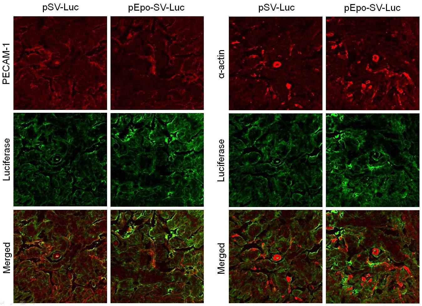 Luciferase expression area in hypercholesterolemic mouse corpus cavernosum tissues. Immunofluorescent double staining of cavernous tissue performed with antibodies to luciferase and PECAM-1, or with antibodies to luciferase and smooth muscle -α actin. The results were similar from four independent samples. PECAM-1 = platelet/endothelial cell adhesion molecule-1.