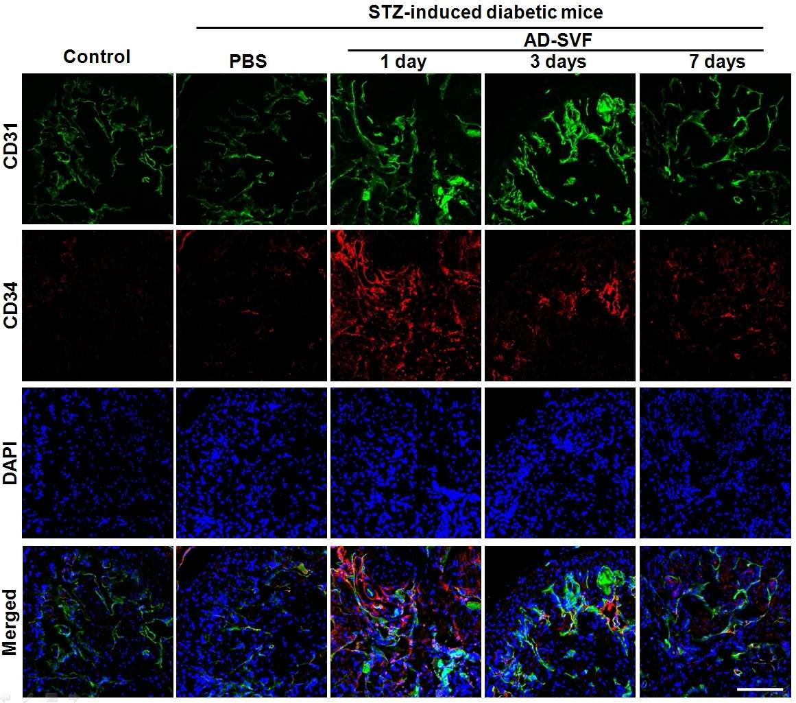 AD-SVF transfer recruits CD34(+)CD31(-) progenitor cell population in the corpus cavernosum tissue. Anti-CD31 (green) and CD34 staining (red) of cavernous tissue from age-matched control or diabetic mice 1, 3, and 7 d after receiving intracavernous injection of PBS (20 μl) or AD-SVF (1 × 105 cells/20 μl). Scale bar=200 μm. Results were similar from three independent experiments. On merged images, red color represents CD34(+)CD31(-) progenitor cell population. STZ = streptozotocin; AD-SVF = adipose tissue-derived stromal vascular fraction.