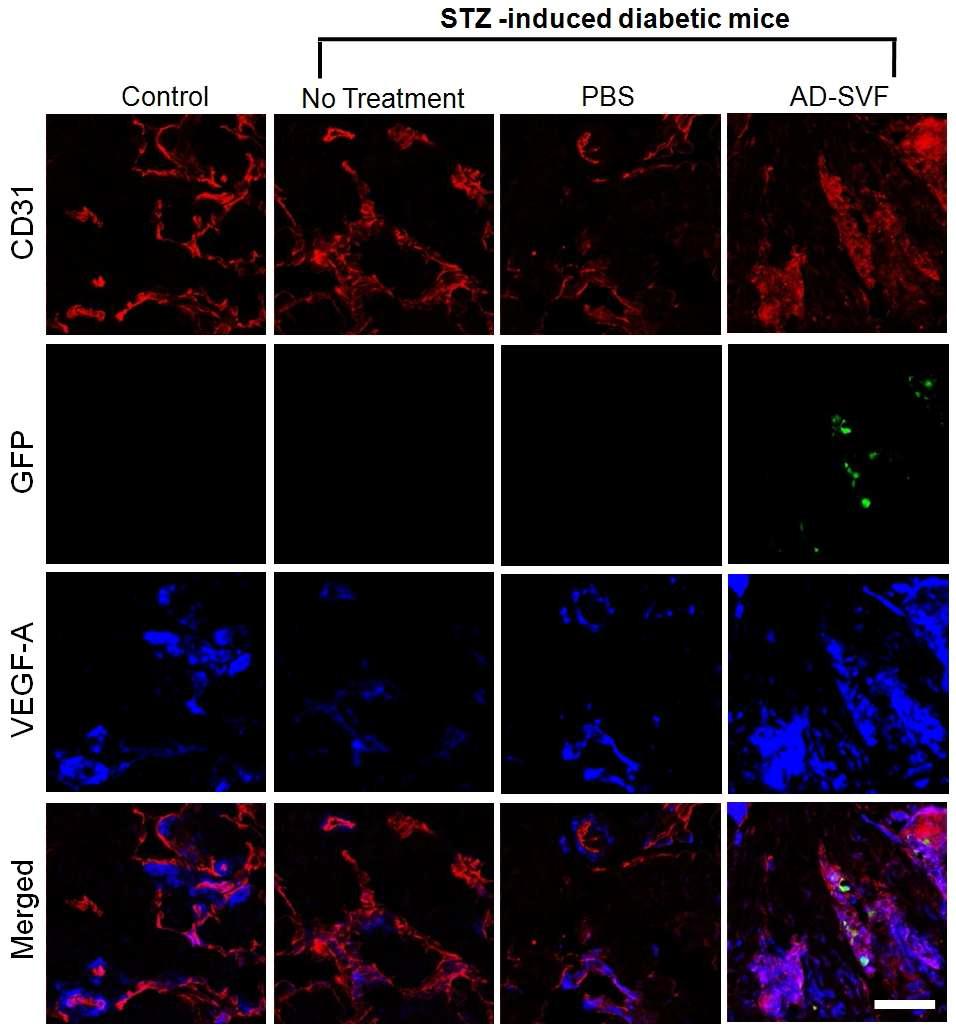 AD-SVF transfer increases VEGF-A expression in the corpus cavernosum tissue. Anti-CD31 and VEGF-A staining of cavernous tissue from age-matched control, untreated diabetic mice, or diabetic mice 1 d after receiving intracavernous injection of PBS (20 μl) or AD-SVF (1×105 cells/20 μl). Scale bar=100μ m. STZ = streptozotocin; AD-SVF = adipose tissuederived stromal vascular fraction; GFP, green fluorescent protein; VEGF-A, vascular endothelial growth factor-A.