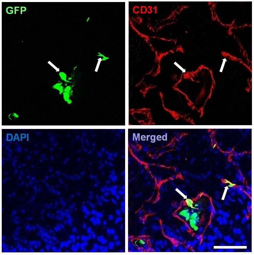Engraftment and differentiation of donor AD-SVF into the host cavernous endothelial cells. Anti-CD31 staining of cavernous tissue from diabetic mice 3 d after receiving intracavernous injection of AD-SVF (1 × 105 cells/20 μl). Arrows indicate the GFP(+) cells that expressed CD31.Scale bar=100 μm. GFP = green fluorescent protein.