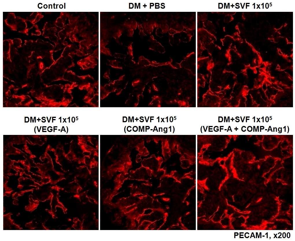 Pretreatment of AD-SVF with combined VEGF-A and COMP-Ang1 additively increases cavernous endothelial content. Anti-CD31 staining of cavernous tissue from age-matched control, or diabetic mice stimulated at 2 wk after intracavernous injection of PBS (20 μl), AD-SVF (1×105 cells), AD-SVF + VEGF-A, AD-SVF + COMP-Ang1, or AD-SVF + VEGF-A + COMP-Ang1. DM = diabetes mellitus; SVF = adistromal vascular fraction.