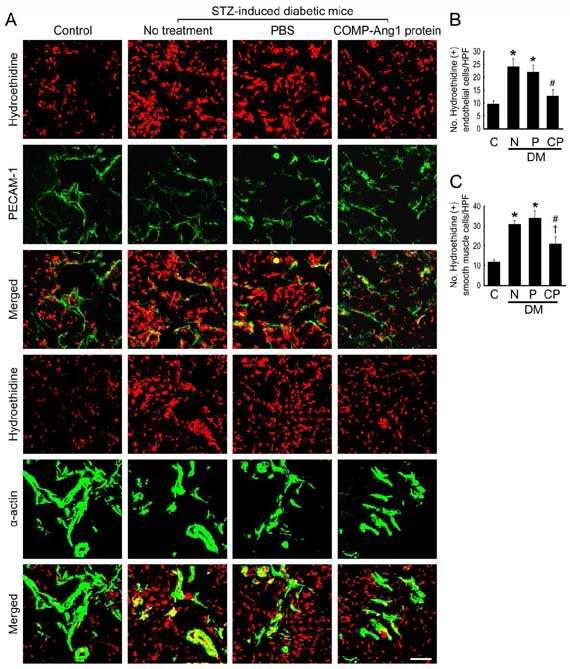 COMP-Ang1 protein transfer decreases cavernous superoxide anion production.