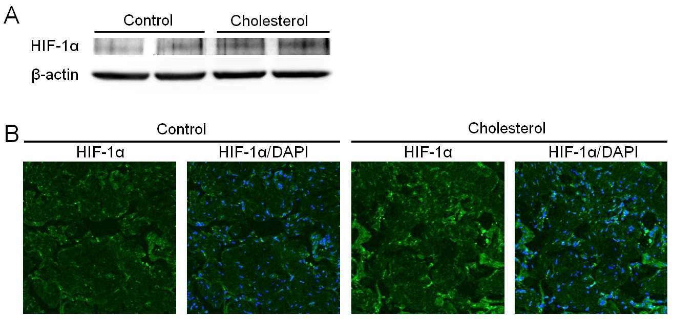 HIF-1α expression in the corpus cavernosum tissue of control and hypercholesterolemic mice. (A) Western blot analysis showing the protein expression of HIF-1α. (B) Immunohistochemical staining of cavernous tissue performed with antibody to HIF-1α. The results were similar from four independent samples. HIF-1α = hypoxia-inducible factor-1α.