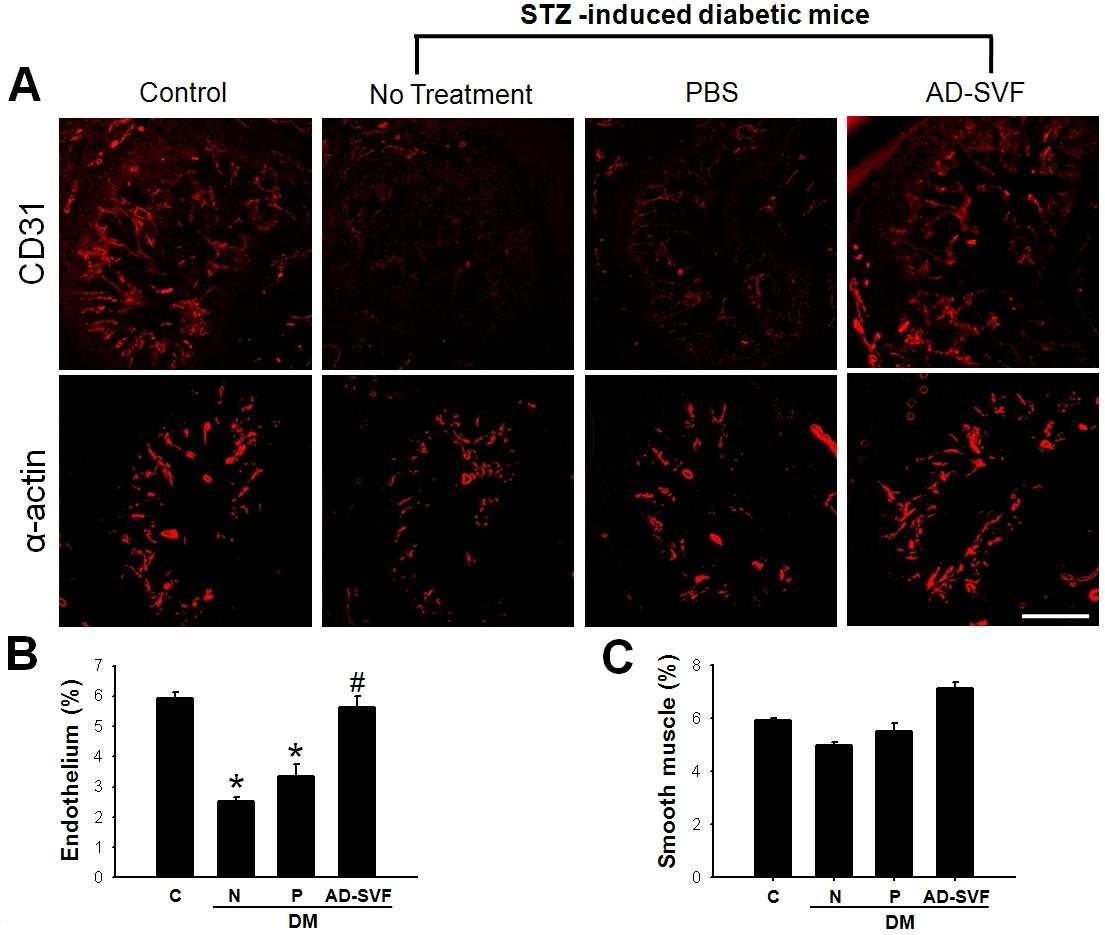 AD-SVF transfer increases cavernous endothelial content. (A) Anti-CD31 and smooth muscle α -actin staining of cavernous tissue from age-matched control, untreated diabetic mice, or diabetic mice 2 wk after receiving intracavernous injection of PBS (20μl) or AD-SVF (1×105 cells/20 μl). Scale bar=200 μm. (B,C) Quantitative analysis of endothelial cell and smooth muscle cell content in cavernous tissue was performed by using an image analyzer. Each bar depicts the mean values (± SE) from n=6 animals per group. *p < 0.01 vs control and AD-SVF-treated diabetic groups, #p < 0.01 vs untreated and PBS-treated diabetic groups. STZ = streptozotocin; AD-SVF = adipose tissue-derived stromal vascular fraction; C = control; N = no treatment; P = phosphate-buffered saline; DM = diabetes mellitus.