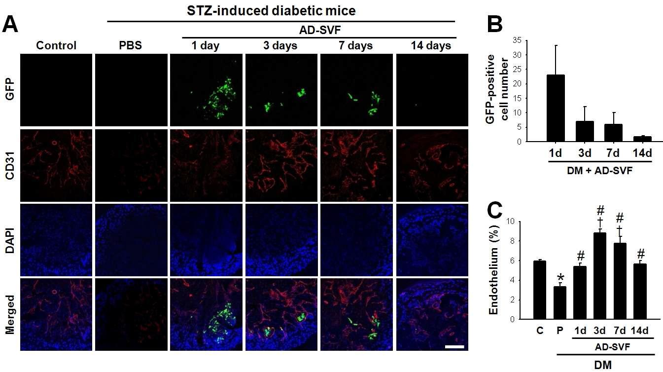 Time-course survival of AD-SVF and expression of CD31 in the corpus cavernosum tissue. (A) Anti-CD31 staining of cavernous tissue from age-matched control or diabetic mice 1, 3, and 7d and 2wk after receiving intracavernous injection of PBS (20 μl) or AD-SVF (1×105 cells/20 μl). Nuclei were labeled with the DNA dye DAPI. Scale bar = 200 μm. (B) Number of GFP-positive AD-SVF in the corpus cavernosum tissue. Each bar depicts the mean values (± SE) from n=4 animals per group. (C) Quantitative analysis of endothelial cell content in cavernous tissue was performed by using an image analyzer. Each bar depicts the mean values (± SE) from n=4 animals per group. *p < 0.01 vs control and AD-SVF-treated diabetic groups, #p < 0.01 vs PBS-treated group. †p < 0.05 vs control group. STZ = streptozotocin; AD-SVF = adipose tissue-derived stromal vascular fraction; GFP = green fluorescent protein; DAPI = DM = diabetes mellitus; C = control; P = phosphate-buffered saline.