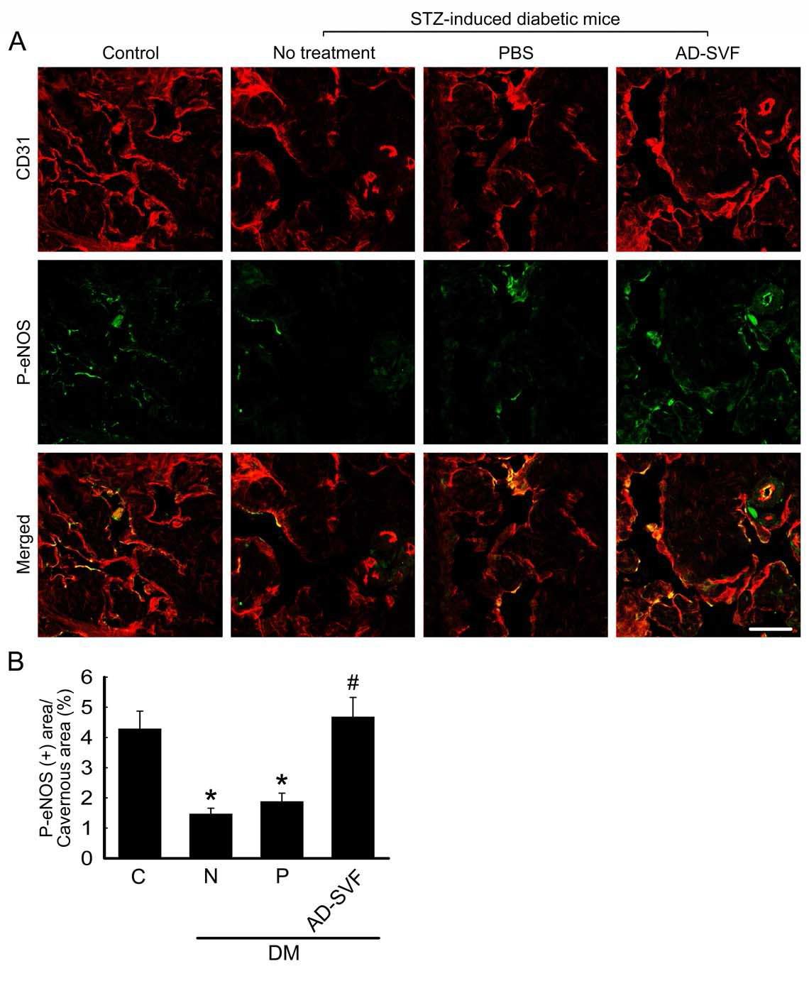 AD-SVF transfer induces cavernous eNOS phosphorylation and increases cGMP concentration. (A) Anti-CD31 (red) and phospho-eNOS staining (Ser1177; green) of cavernous tissue from age-matched control, untreated diabetic mice, or diabetic mice 2 wk after receiving intracavernous injection of PBS (20 μl) or AD-SVF (1 × 105 cells/20 μl). Scale bar=200μm. (B) Each bar depicts the mean values (± SE) from n=6 animals per group. *p < 0.01 vs control and AD-SVF-treated diabetic groups, #p < 0.01 vs untreated and PBS-treated diabetic groups. STZ = streptozotocin; AD-SVF = adipose tissue-derived stromal vascular fraction; C = control; N = no treatment; P = phosphate-buffered saline; DM = diabetes mellitus.