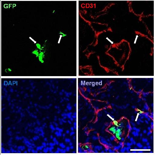 Engraftment and differentiationof donor AD-SVF into the host cavernous