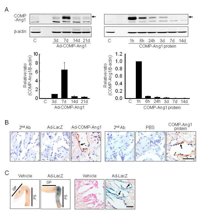 In vivo COMP-Ang1 or β-gal expression in diabetic corpus cavernosum tissue.