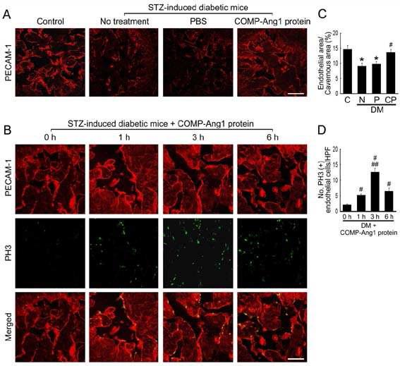 COMP-Ang1 protein transfer increases cavernous endothelial content through enhanced endothelial cell proliferation.
