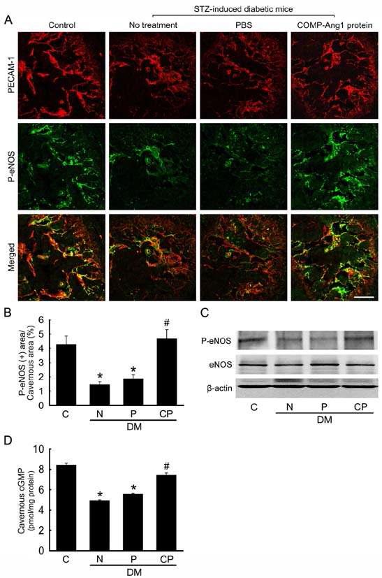 COMP-Ang1 protein transfer induces cavernous eNOS phosphorylation and increases cGMP concentration.