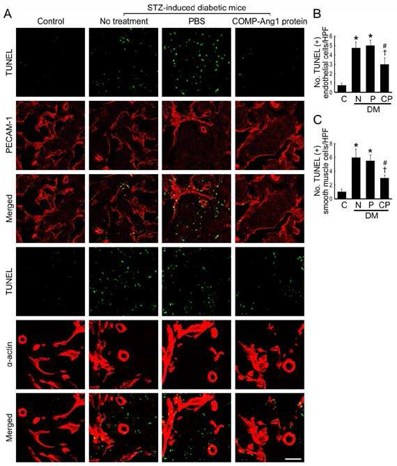 COMP-Ang1 protein transfer decreases apoptosis in cavernous endothelial cells and smooth muscle cells.
