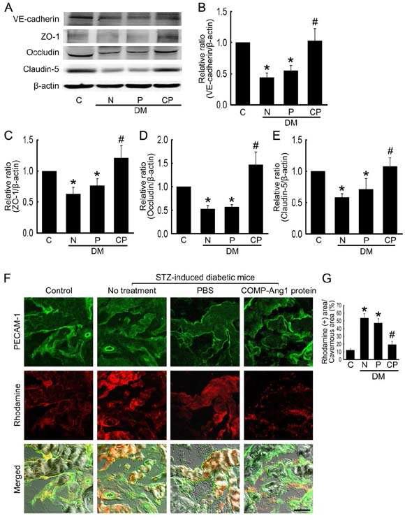 COMP-Ang1 protein transfer restores endothelial cell-to-cell junction proteins and decreases cavernous endothelial permeability.