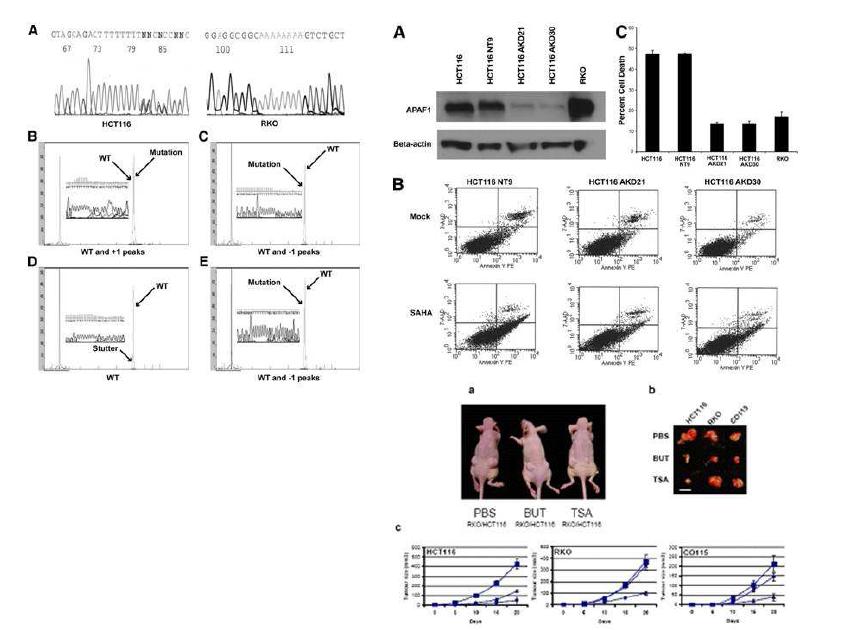 대장암에서 HDAC2 유전자변이에 따른 HDAC inhibitor 에 대한 내성