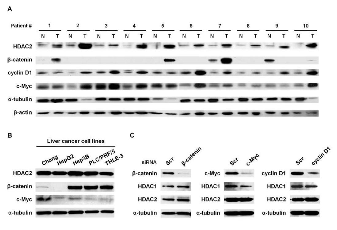 간암에서 HDAC2 유전자 발현과 Wnt signaling 간의 상관관계