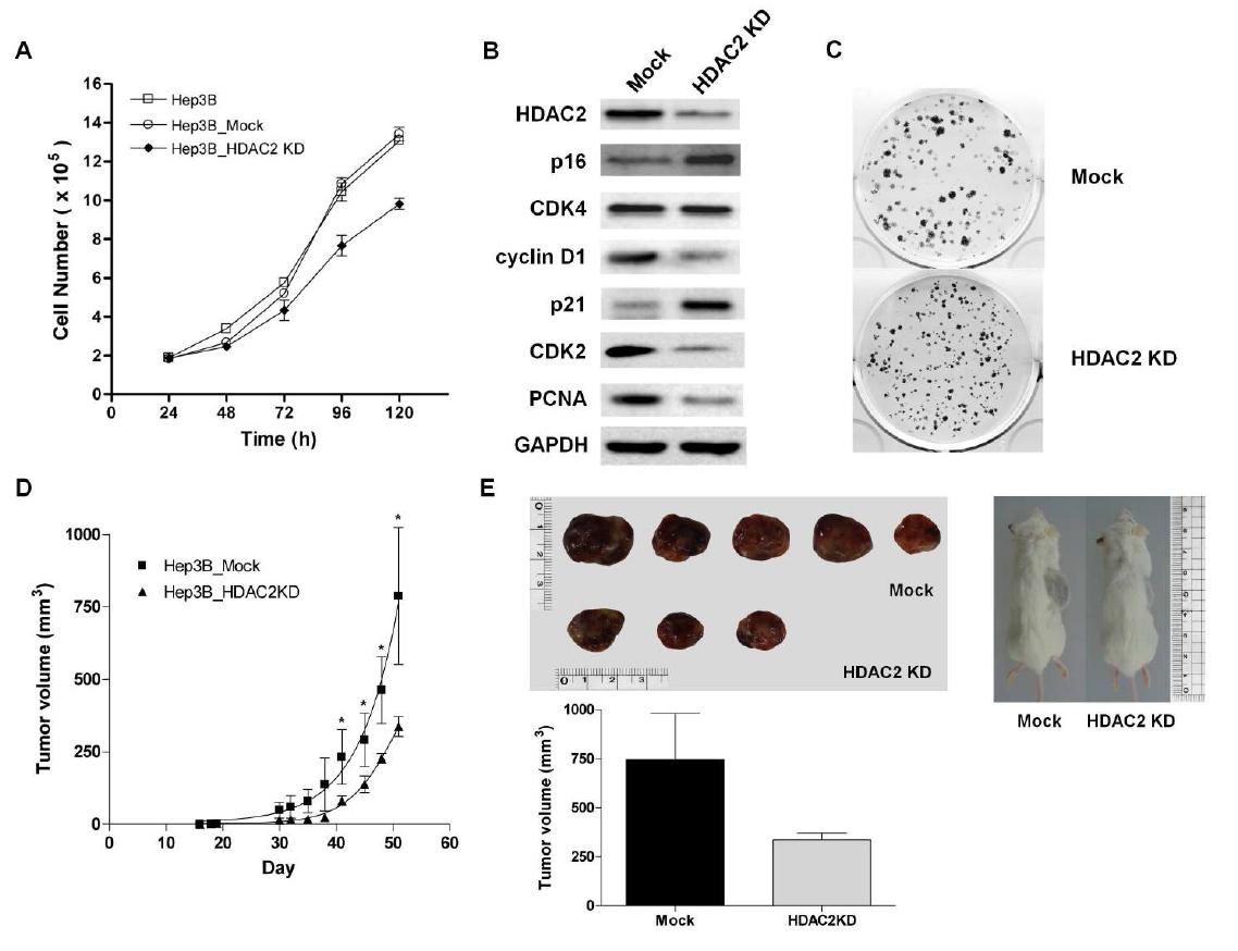 HDAC2 유전자가 지닌 in vitro tumorigenic potential의 검증 및 Mouse xenograft를 통한 in vivo 종양 형성능의 고찰