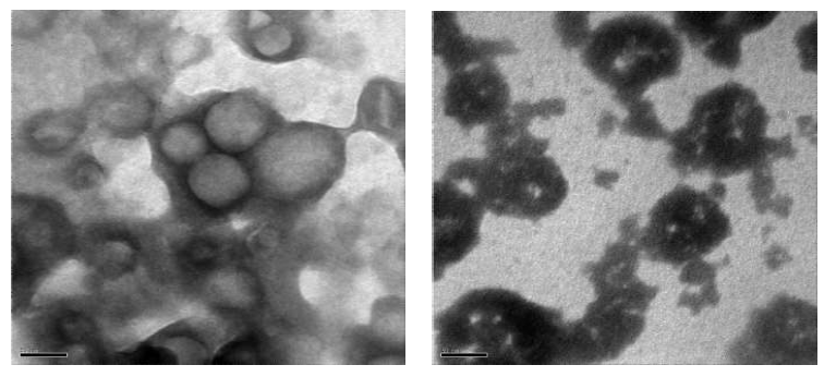 Transmission electron micrographs of plain liposomes(A) and chitosan coated liposomes(B) in aqueous medium at X 100K magnification