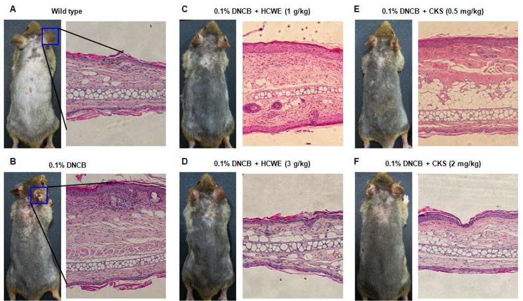 Histopathological analysis.