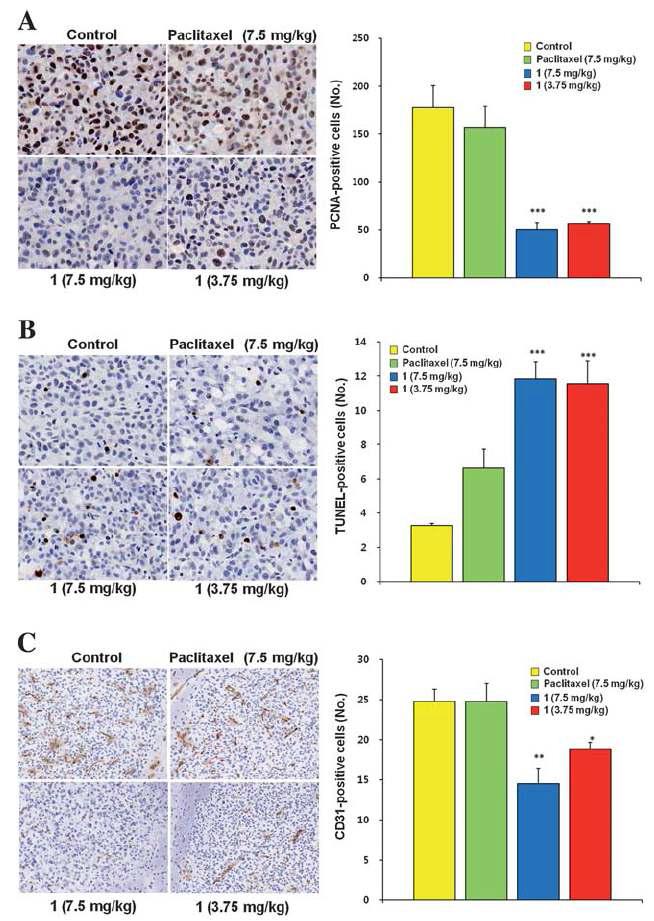 The effects of paclitaxel-carrier conjugate (po) on (A) tumor cellproliferation (brownish stained cells are PCNA-positive), (B) tumor cell apoptosis (brownish stained cells are TUNEL-positive), and (C) microvessel density (CD31-positive cells organized into capillary-like channels) in the mouse brain. Proliferating, apoptotic and endothelial cells were analyzed by anti-PCNA antibody, TUNEL assay and anti-CD31 antibody, respectively, in tumor masses. Numbers of PCNA-, TUNEL-, and CD31-positive cells were calculated and compared