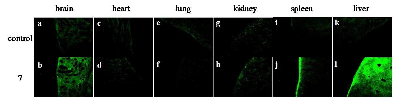 Tissue distribution patterns of compound 7 (bottom) against thecontrol (top) in mouse.