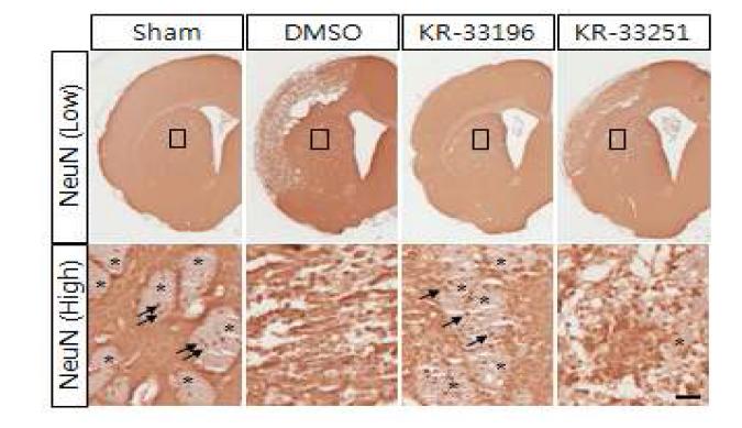 뇌졸중동물모델에서 KR-33196과 KR-33251 화합물에 의한 선조체의 신경세포와 axon 보호효과