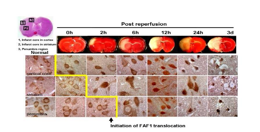 Rat 뇌졸중 동물모델에서 mitochondrial dysfunction 전에 발생하는 FAF1이동 확인