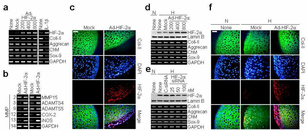 Hif-2α does not regulate ECM synthesis under either normoxic or hypoxic conditions.