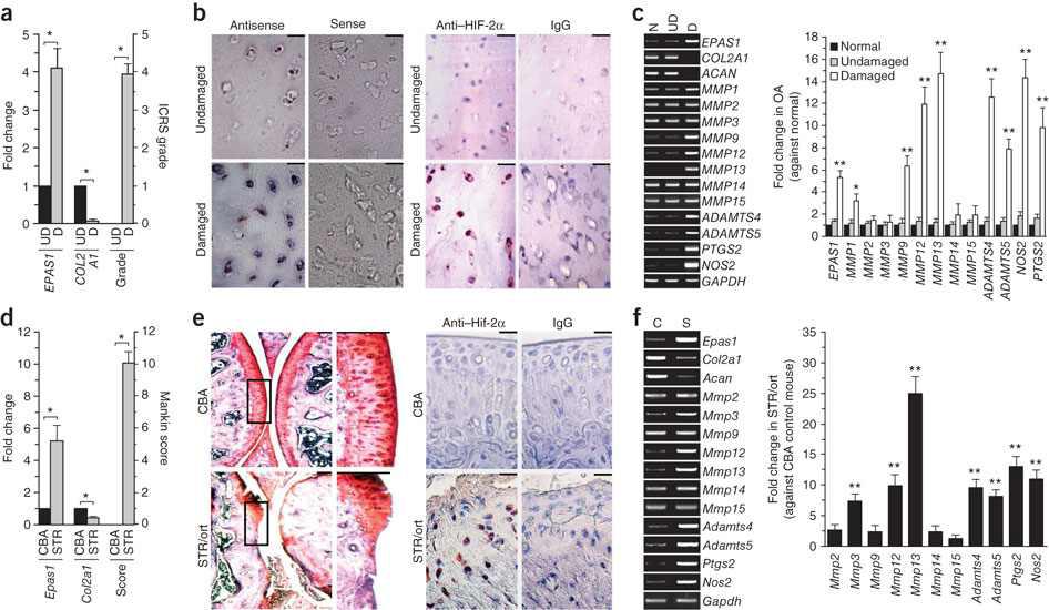 HIF-2α is overexpressed in OA cartilage of humans and STR/ort mice.