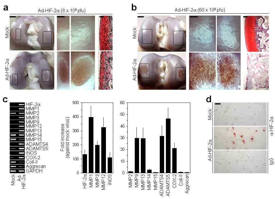 Over- expression of HIF-2α triggers cartilage destruction in rabbits.