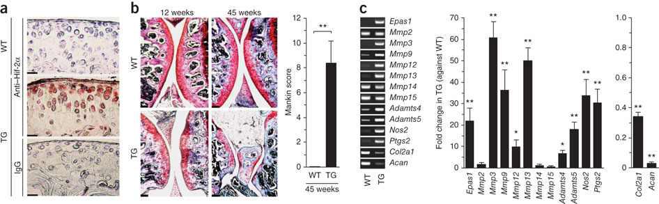 Chondrocyte-specific Epas1-transgenic (TG) mice show spontaneous cartilage destruction.