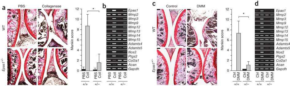 Genetic deletion of one allele of Epas1 inhibits OA cartilage destruction.
