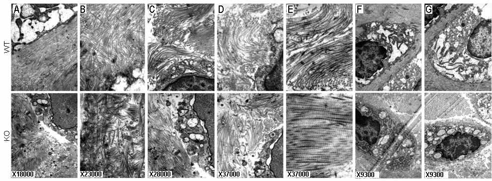 Ultrastructure of articular cartilage in WT and CYTL1 KO mice.