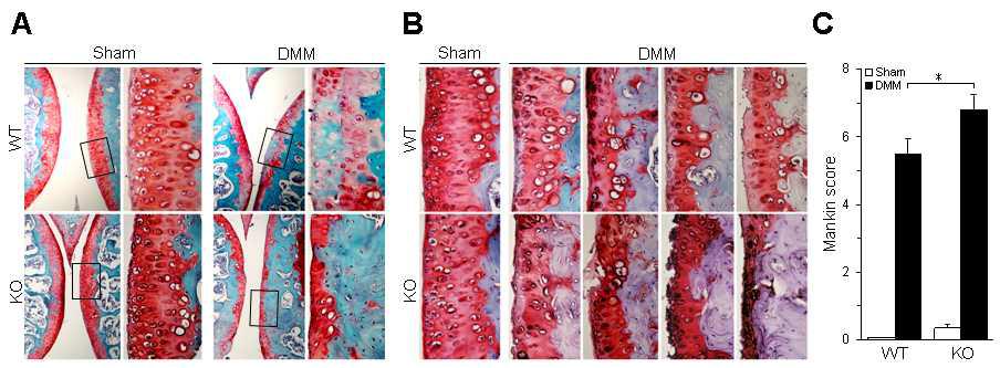 CYTL1 KO stimulates DMM-induced OA cartilage destruction.