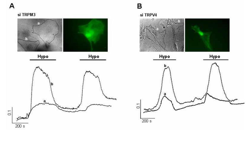 조골세포에서 TRPM3, TRPV4 siRNA를 통한 TRPM3 TRPV4의 기능 확인